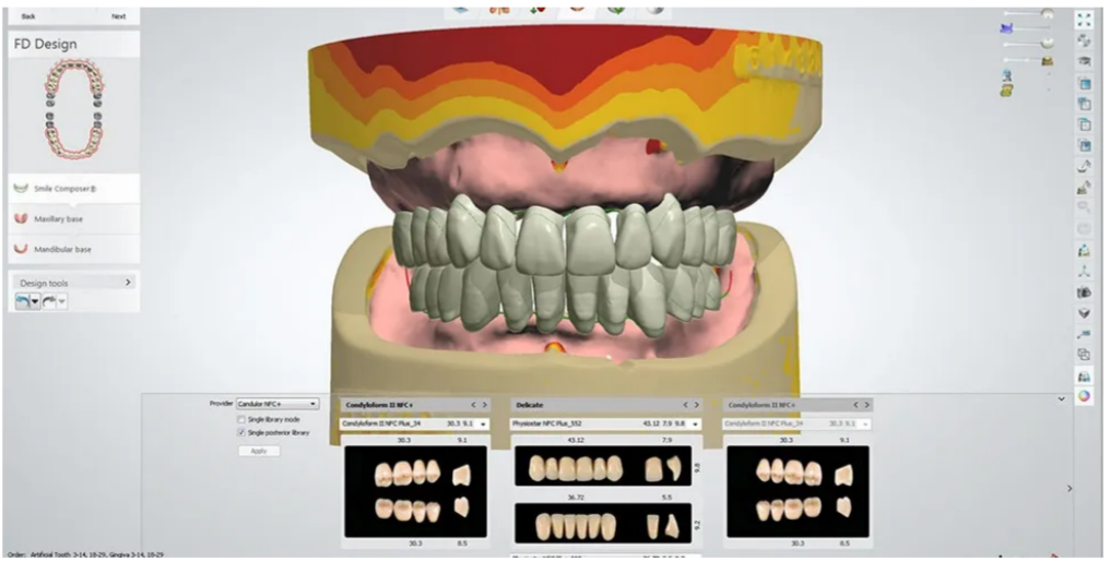 CAD/CAM digital denture design software showing 3D tooth models at Comfy Denture Clinic