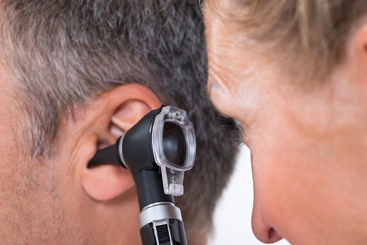 Facial Prosthetics