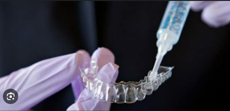 Dental professional applying whitening gel into a custom teeth whitening tray